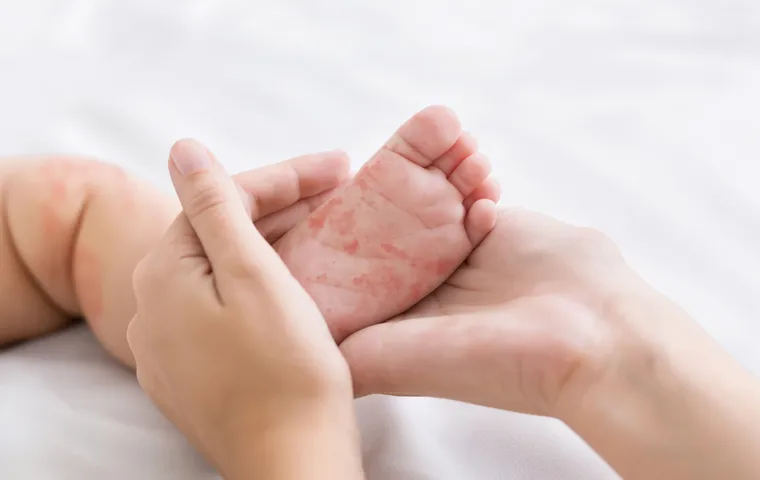 Roseola Signs & Symptoms: How To Tell If Your Child Has Roseola